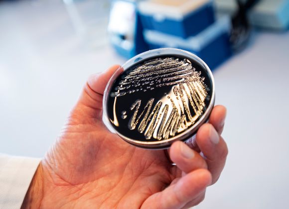 Fingerprinting of bacteria